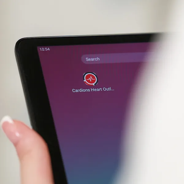 Mobile application for recording heart signals